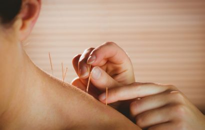 Reasons Why Acupuncture Is Essential: A Guide For First-Timers