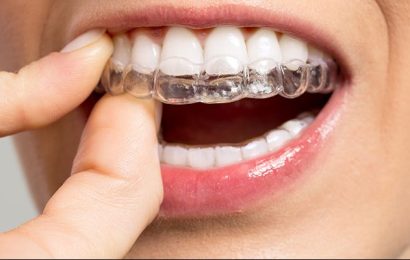 Invisible Braces, Is it For You? Find Out Here