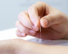 What to Expect During a Chinese Acupuncture Treatment