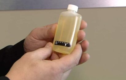 Last-Minute Tips to Pass Your Urine Drug Test Successfully