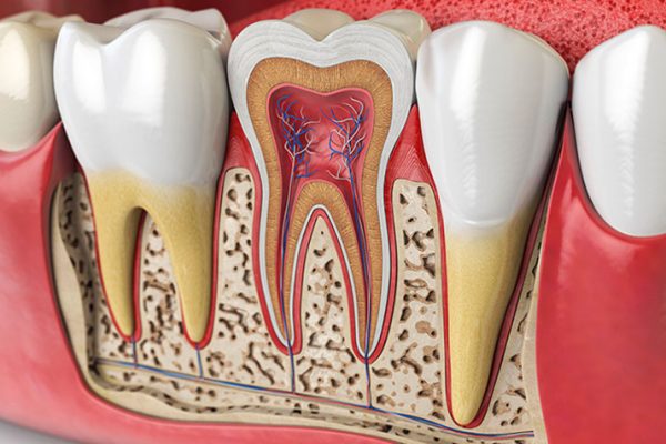 root canal treatment singapore