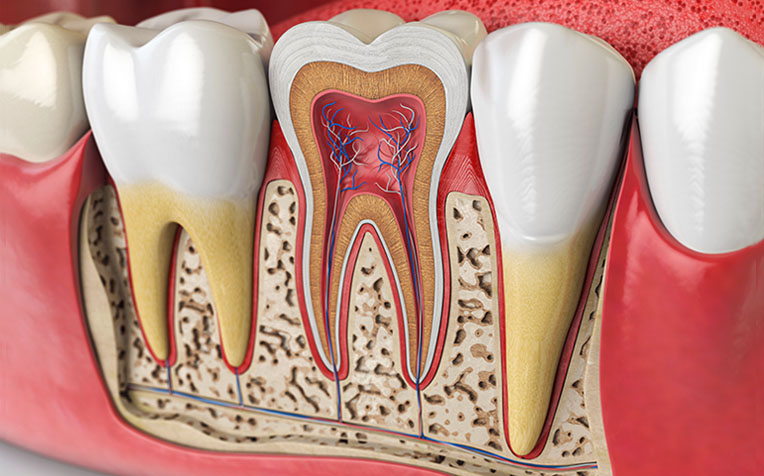 root canal treatment singapore